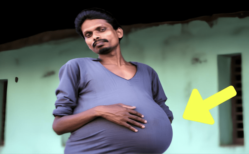 Man Gets Routine Check-Up – Doctor Looks At X-Ray And Whispers: “I’m Sorry” ➤ Buzzday.info