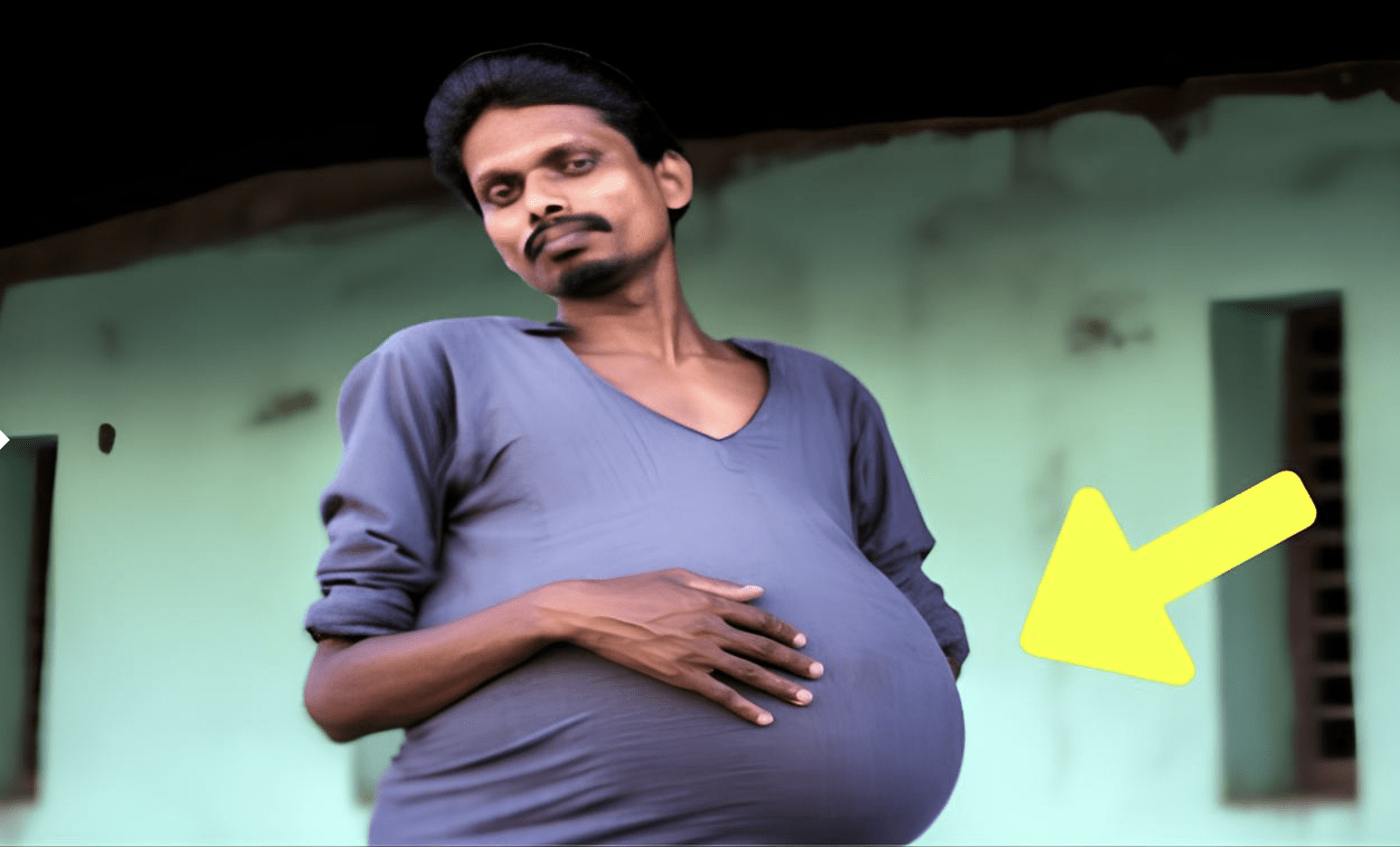Man Gets Routine Check-Up – Doctor Looks At X-Ray And Whispers: “I’m Sorry” ➤ Buzzday.info