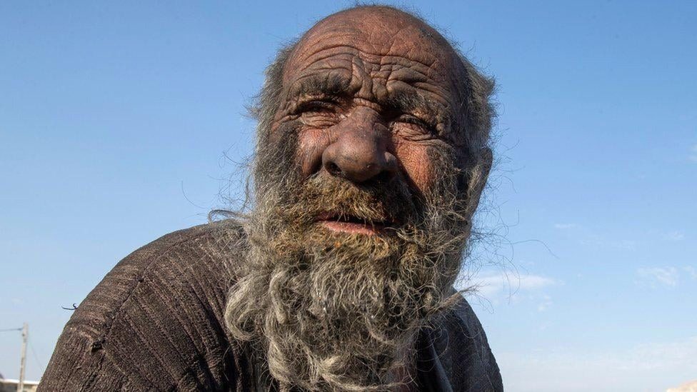 Ugh! This man hasn’t washed in 65 years! ➤ Buzzday.info